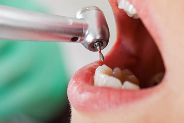 Emergency Gum Pain Relief in GA